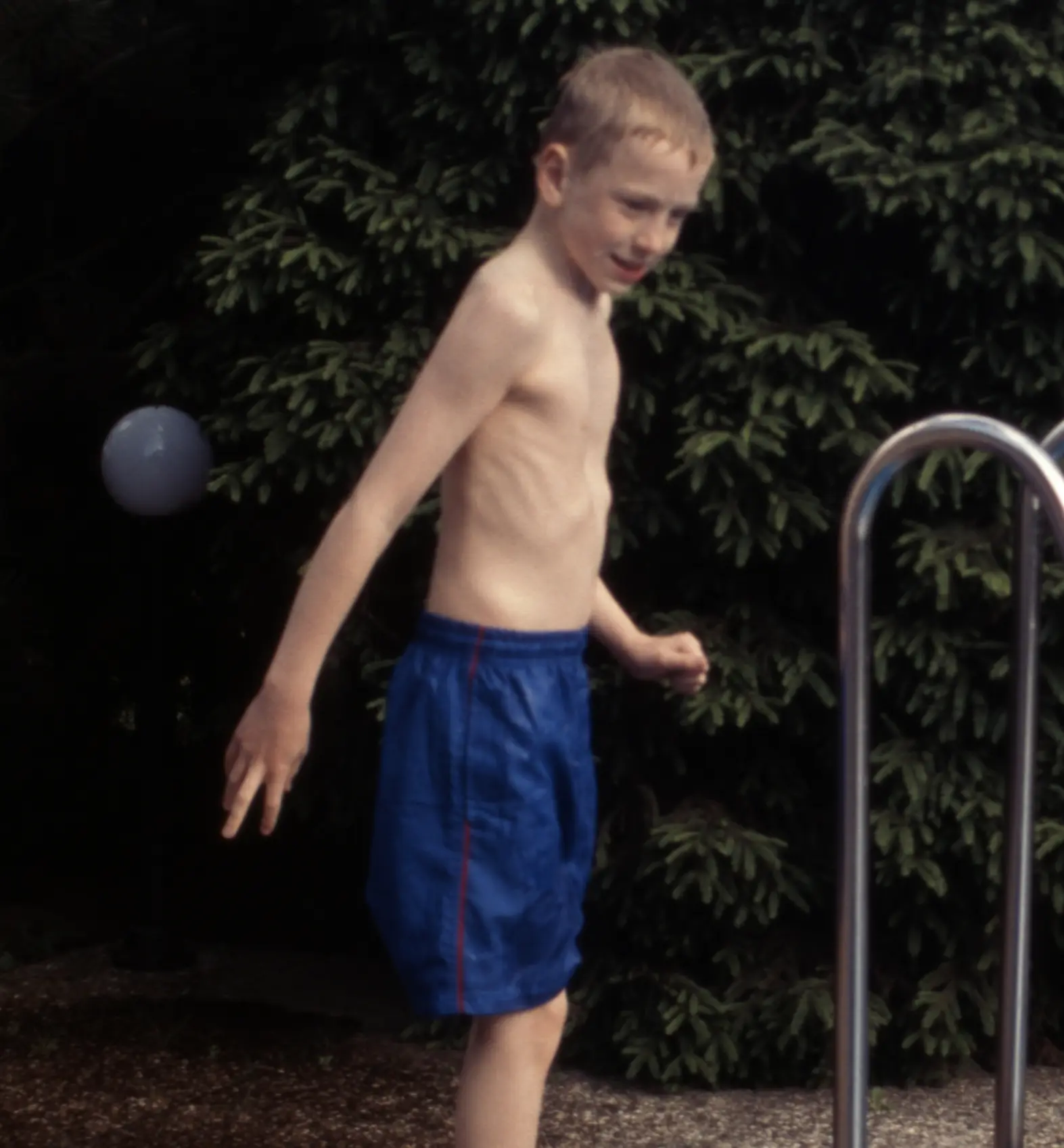 Christoph als Kind mit Trichterbrust am Schwimmbecken